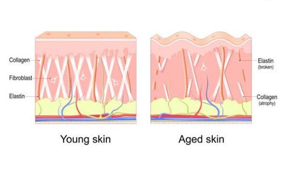 Collagen